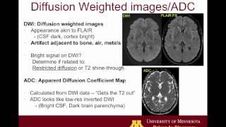 Brain MRI sequences 101