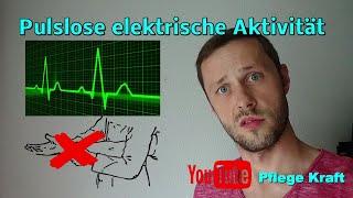 Normales EKG aber keinen Puls???
