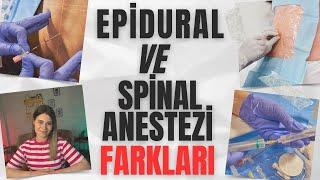 Epidural Anestezi ve Spinal Anestezi Nedir? Doğumda Hangi Anestezi Yöntemi Tercih Ediliyor ?