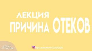 Причина отеков. Живая лекция.