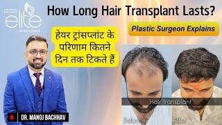 How Long Hair Transplant Lasts? Expert Insight by Dr Manoj Bachhav | Bachhav Cosmetic Surgery Clinic