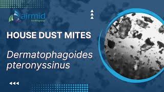 House Dust Mites - under the microscope at airmid healthgroup