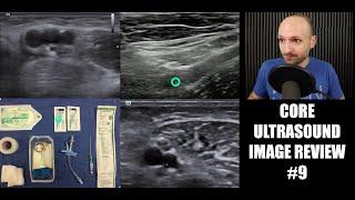 Core Ultrasound Image Review #9!