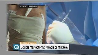 Are Preventative Double Mastectomies Worth The Risk?