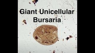 Microscopic life. Bursaria, Rotifers, Spirostomum, Algae Colonies.