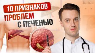 10 признаков проблем с печенью. Когда стоит обратиться к гепатологу?