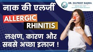 नाक की एलर्जी - लक्षण, कारण और सबसे अच्छा इलाज ! Allergic Rhinitis - Causes, Symptoms & Treatment