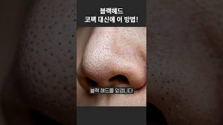 블랙헤드 없애는 방법!! 코팩 대신에 이 방법으로 없애보세요! #블랙헤드 #코팩 #여드름