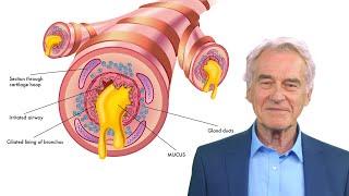 MUCUS PERSISTENT ÎN GÂT - cele mai frecvente 3 CAUZE