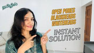 தமிழில் - How I cured my Black Heads/White Heads & Shrink Open Pores in Tamil | Instant Results