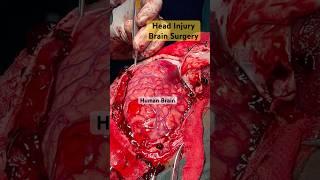 What the Human Brain Really Looks Like Surgical View #brain  #MedicalShorts #brainsurgery  #shorts