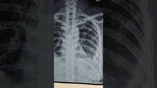 differential diagnosis?