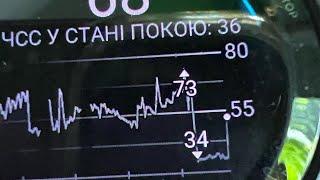 Відповіді на запитання про насиль-ство в церкві. Особистий досвід. «Нотатки дружини пастора», #390