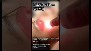 피코슈어 피코토닝 #피코레이저  #레이저토닝 #picosure #laser #pigments
