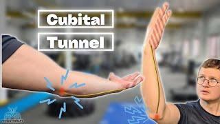 The BEST Exercises For Cubital Tunnel Syndrome!