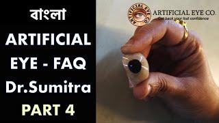 Artificial Eye FAQs 4 | Dr Sumitra | INTERVIEW in Bengali