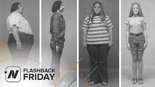 Flashback Friday: Can Morbid Obesity Be Reversed Through Diet?