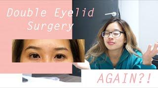 Double Eyelid Surgery in Korea... AGAIN?!  |  Watch Me Recover (Non-Incisional)