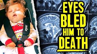 Infant’s Brain Torn & Eyes Bled Him To Death