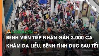 Bệnh viện tiếp nhận gần 3.000 ca khám da liễu, bệnh tình dục sau Tết