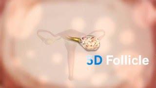 5D Follicle измерение фолликулов
