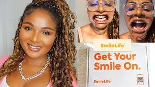 STRAIGHTENING MY TEETH WITH SMILELIFE CLINIC #smilelife #teethstraightening #invisiblealigners