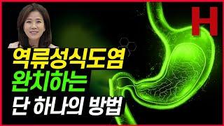 역류성식도염 완치법 유일한 하나 공개