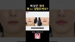 이 분은 입술필러 몇 cc를 넣었을까요?
