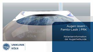 Augen lasern - Femto-Lasik | PRK | (Patienteninformation Augenklinik) | Uniklinik Köln