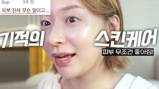 당장따라해보세요! 누구나 피부 좋아지는 기적의 스킨케어법(광고없는 찐템추천)ㅣ 시술 스킨케어로만 피부리즈된 썰!