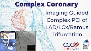 Imaging Guided Complex PCI of LAD/LCx/Ramus Trifurcation - Feb 2023