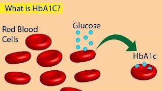 HbA1C Test Glycosylated Hemoglobin Test for Diabetes