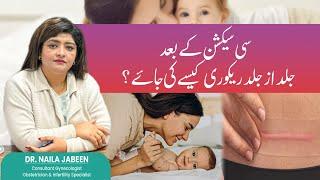 Speedy Recovery After C-Section: Expert Tips | Dr. Naila Jabeen