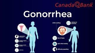 Gonorrhea