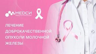 Доброкачественные новообразования груди: фиброаденомы, кисты, уплотнения, внутрипротоковые папилломы