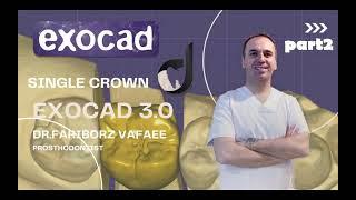 How to design single crown like a pro in exocad 3.0 (part2)