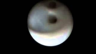 innoMedicus - LaDuScope - Milk Duct Endoscopy - 2011