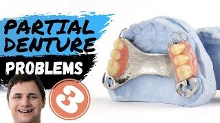 Problems with Partial Dentures | Removable Denture Types