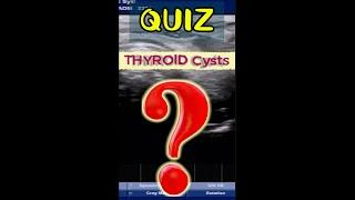 QUIZ ?   Thyroid Cyst.