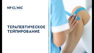 Терапевтическое тейпирование