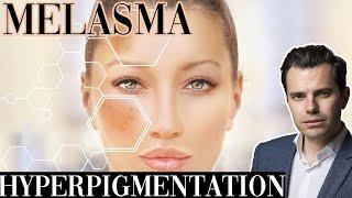 Comment traiter le MELASMA et L'HYPERPIGMENTATION? Mes conseils