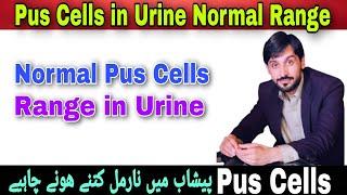 Pus Cells in Urine Normal Range | Pus Cells in Urine | Pus Cells | Pus Cells Normal Range Per HPF