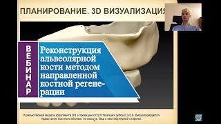 Реконструкция альвеолярной кости методом направленной костной регенерации