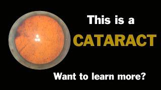 Uncovering the Mystery of Cataracts: What You Need to Know!