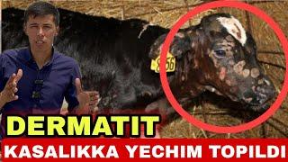 DERMATIT YANI GUL KASALIKKA YECHIM TOPILDI