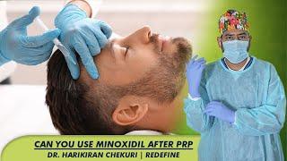 Can You Use Minoxidil after PRP | Dr. Harikiran Chekuri | Redefine #prp #hairtransplant #hair