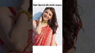 Kajal Agarwal before and after plastic surgery #kajalagarwal #tamil #shraddhakapoor #plasticsurgery