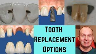 5 ways to replace a missing front tooth.