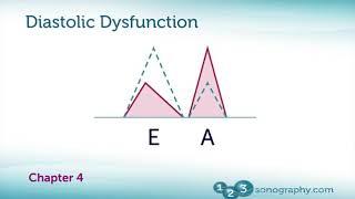 Echocardiography Diastolic Dysfunction Measurement with Demonstration