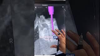 3d Spine Surgery #ucsf